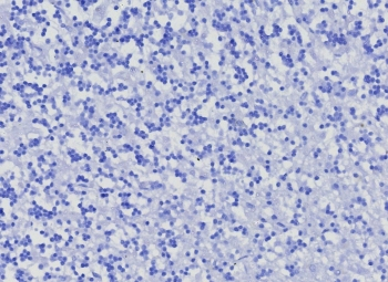 CD10 Antibody / Neprilysin