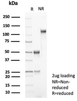 CTNNB1 Antibody / Beta Catenin