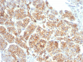 CTNNB1 Antibody / Beta Catenin