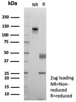MLH1 Antibody / MutL Homolog 1