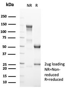 MLH1 Antibody / MutL Homolog 1