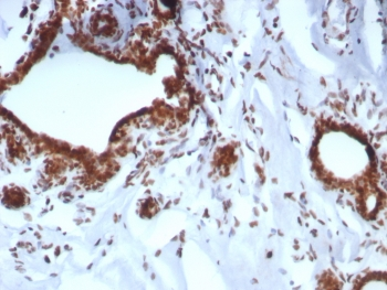 BAP1 Antibody / BRCA1-Associated Protein 1