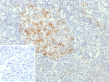 PDCD1 Antibody / PD-1 / PD1