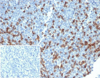 PDCD1 Antibody / PD-1 / PD1