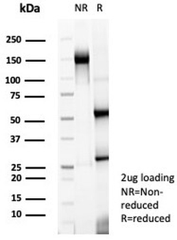 Nucleolin Antibody