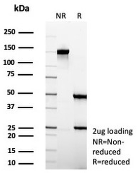 Villin Antibody