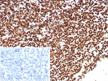 Ku80 Antibody / XRCC5