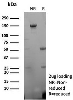 Desmin Antibody