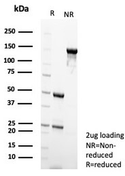 IDH1 Antibody / Isocitrate Dehydrogenase (R132H mutant)