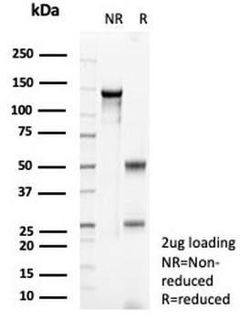 SATB2 Antibody