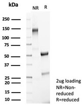 SATB2 Antibody