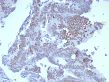 SATB2 Antibody