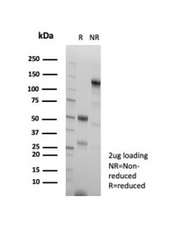 HSP60 Antibody