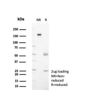 HSP60 Antibody