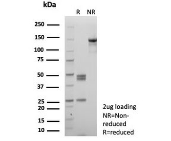 SATB2 Antibody