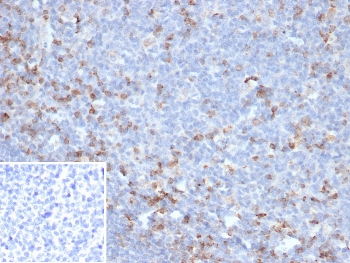 CTLA-4 Antibody / CD152
