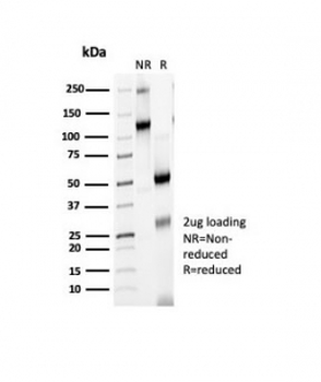 CTLA-4 Antibody / CD152
