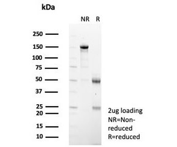 IL1RA Antibody / Interleukin-1 Receptor Antagonist / IL1RN