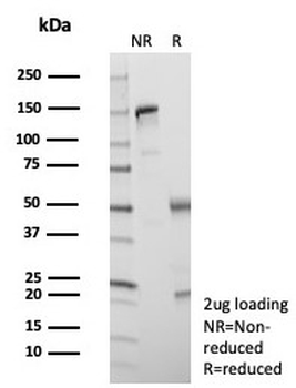 SATB2 Antibody