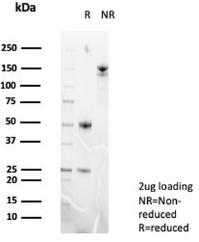 hCG Receptor / LH Receptor Antibody