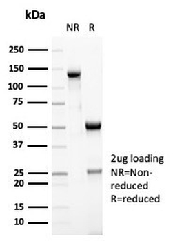 MSH6 Antibody