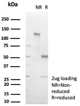 FABP3 Antibody