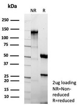 FABP1 Antibody