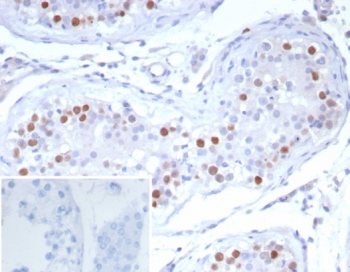 PRAME Antibody / OIP-4