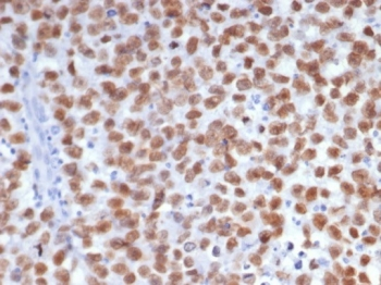 SALL4 Antibody / ZNF797
