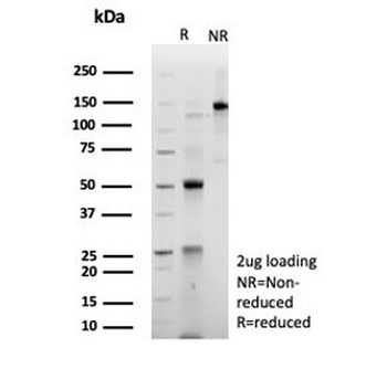 ACTN2 Antibody / Alpha Actinin 2 / Sarcomeric Alpha Actinin