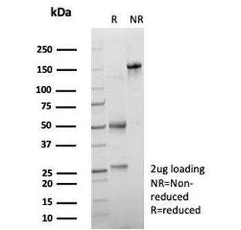 BATF3 Antibody / SNFT