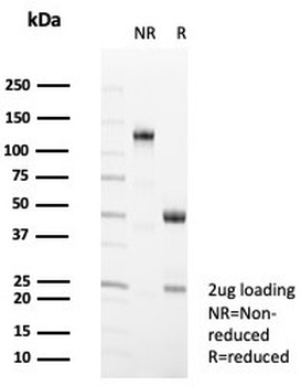 CD35 Antibody / CR1