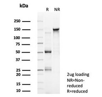 LRH1 Antibody / NR5A2