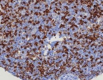 CD45RA Antibody (Leukocyte marker)