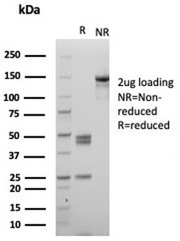 MPZ Antibody / Myelin Protein Zero