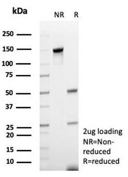 CD48 Antibody (Pan Leukocyte Marker)
