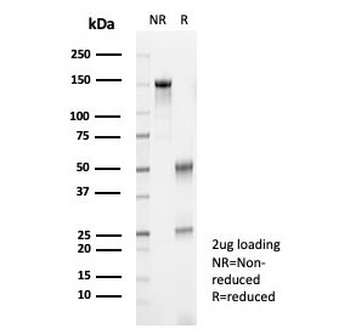 S100A12 Antibody / CGRP