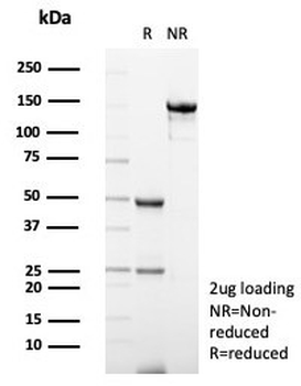 S100A12 Antibody / CGRP