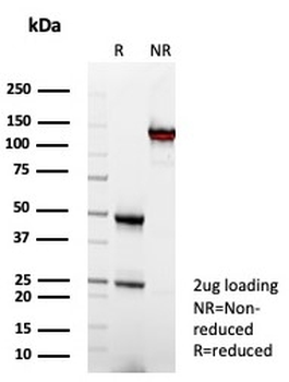 FCGR1A Antibody / CD64