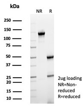 FCGR1A Antibody / CD64