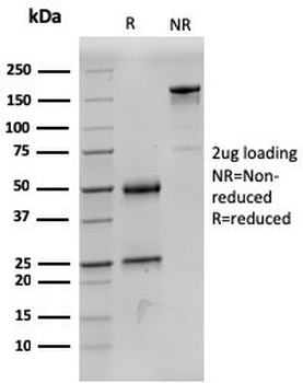 SDHB Antibody / Succinate dehydrogenase B