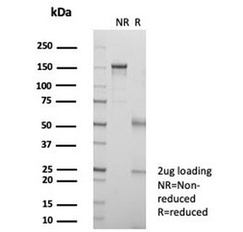 KIF2C Antibody / MCAK
