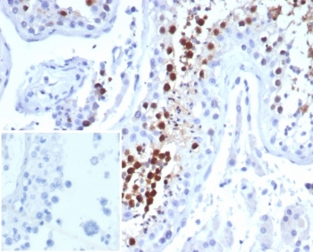 KIF2C Antibody / MCAK