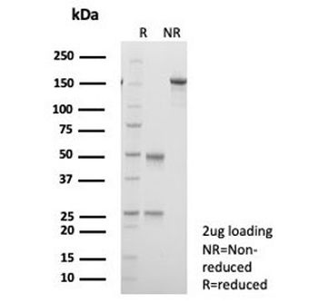 Kallikrein 5 Antibody / KLK5