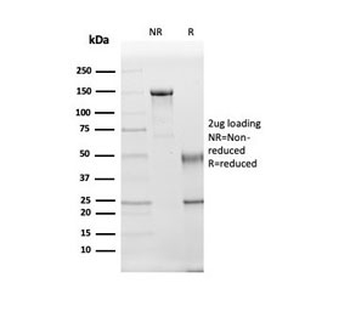 Kallikrein 5 Antibody / KLK5