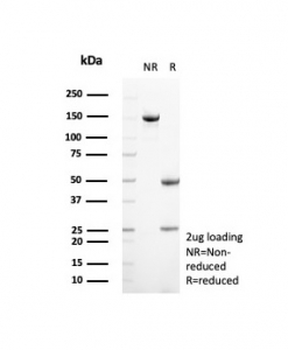 SBSN Antibody / Suprabasin