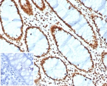 BRG1 Antibody / SMARCA4
