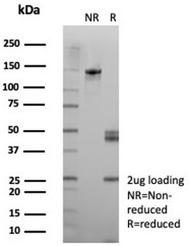 Desmoglein 3 Antibody / DSG3