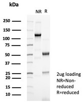 N-Cadherin Antibody / CDH2