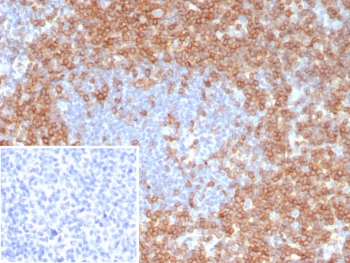 CD7 Antibody